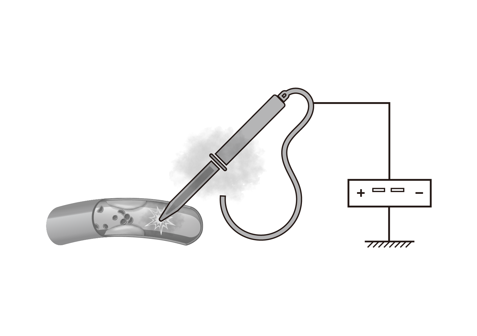 冠动脉钙化冲击波碎石系统_医疗